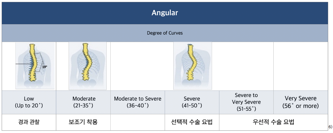 특발성 측만증의 측만정도별 분류
